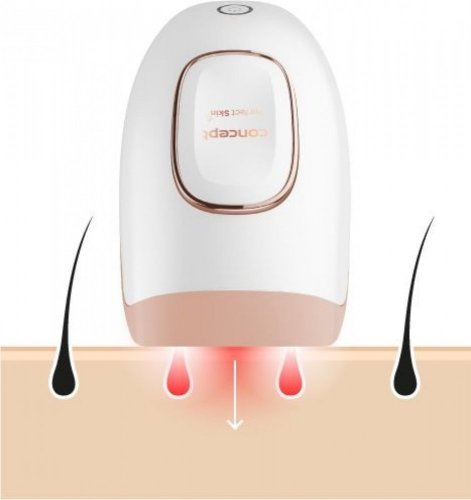 Epilátor Concept IL3000 IPL Perfect Skin